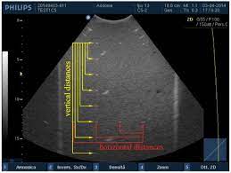 Accuracy In Distance Measurements For Each Pair Of Point Targets The Download Scientific Diagram