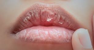 Petua bibir merah dan lembab. 8 Tips Paling Efektif Untuk Elak Bibir Merekah Cara Merawat Barulah Dapat Bibir Mungil