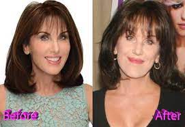 You only have to indicate the short deadline and our support team will help pick the best and most. Reasons Why Robin Mcgraw Plastic Surgery Rumors Could Be True