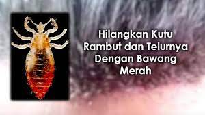 Cara menghilangkan kutu rambut dengan serit ini sebenarnya tidak bisa membunuh kutu rambut secara alami, tapi lebih tepatnya 'mengusir' kutu dari rambut dan kulit kepala. Ubat Hilangkan Kutu Pertanyaan T