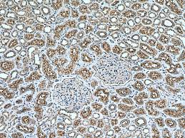 Image result for P-Glycoprotein