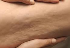 Image result