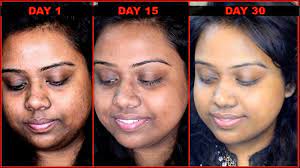 As individual ages, they will have fine lines and wrinkles on below eyes, forehead, under the eyes, between the eyebrows as well. How I Got Rid Of Pigmentation Darkness Around Mouth With Diy Serum 100 Result Within 10 Days Youtube