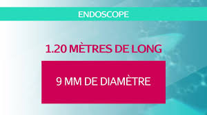 A répondu december 22, 2019 · l'auteur a 613 réponses et 3,9 m vues de réponse. Fibroscopie Endoscopie Comment Ca Se Passe