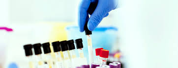 Help your kidneys work harder to urinate more and get rid of all drug residues by drinking diuretic drinks, such as cranberry juice or coffee. Creatinine Urine Test