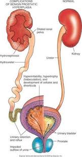Marvel Hospital Is One Of The Top Urology Nephrology Kidney Specialist Hospital In Bangalore India For Renal Tr In 2020 Nurse Nursing Mnemonics Nursing Information