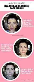 Pin On Help Acne Blackheads Pimples Blemish Treatments