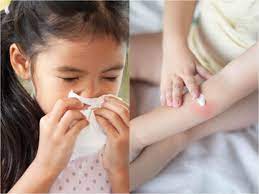 Here's what we do know it's important to be open about the coronavirus with your kids. Experts Are Now Warning Of Another Coronavirus Symptom In Kids Covid Toes Times Of India