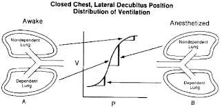 In dorsal or ventral decubitus, the patient is on the back or abdomen, respectively. Physiology Of The Lateral Decubitus Position Open Chest And One Lung Ventilation Springerlink