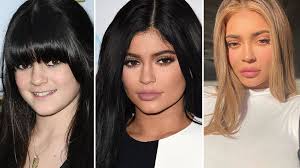 It seems that with whatever outfit she's wearing, her hair always matches. Kylie Jenner Before And After Pictures Of Her Drastic Transformation Revealed Capital