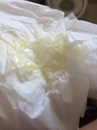Mucus Plug Question Tmi Pic Included Don T Open If You Don T Want To See Or Participate Babycenter