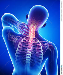 Uw health orthopedics and rehabilitation physician james leonard believes a thorough understanding of the spine's anatomy can help patients understand how to. Anatomy Of Male Back And Neck Pain In Blue Illustration 26852014 Megapixl