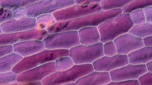 Under the electron microscope, the cell details are revealed more detailedly. Plant Cell Plasmolysis Light Microscopy Stock Video Clip K009 3986 Science Photo Library