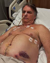 Jair M. Bolsonaro | - Sigo internado na UTI do Hospital DF Star, ainda em fase de recuperação após mais um procedimento cirúrgico. Tenho me mantido estável,... | Instagram