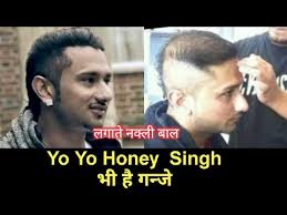 The star was seen looking healthy this weekend outside his brother's marriage ceremony and wearing his own. Case Study Yo Yo Honey Singh Hair à¤• à¤¯ à¤¹à¤¨ à¤¸ à¤¹ à¤• à¤¬ à¤² à¤…à¤¸à¤² à¤¹ Youtube