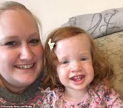 The hair removal cream is a mixture of lemon and chamomile which makes it the right choice for all skin types. Toddler Ends Up Looking Like Pennywise From It After Putting Hair Removal Cream On Her Locks Daily Mail Online