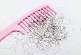 Hair loss ,treatment ,after delivery, post pregnancy ,natural hair growth, remedy, superprincessjo,how to stop, treat, control ,prevent, hair fall ,post pregnancy,baby, delivery,using hair oil.post pregnancy hair loss remedy,pregnancy and hair loss after birth. Hair Fall After Pregnancy Reasons Signs Treatment