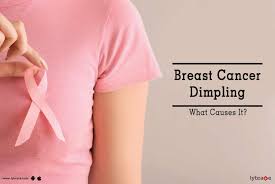 A dimple on the breast does not always mean breast cancer but if it is a new finding, it should be investigated as the formation of a tumor can sometimes pull the skin into the breast causing the dimple. Breast Cancer Dimpling What Causes It By Dr Nisha Sharma Mangal Lybrate