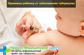 К чему чешется правая рука, если видимых причин на это нет? Mantu Cheshetsya Chto Eto Znachit I Chto Delat Esli Rebenok Raschesal Mantu Poliklinika 8