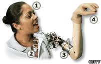 Beebs on Claudia Mitchell, the second person to be fitted with the bionic arm. Cool video there. What is a bionic arm? From the RIC page: - _42090714_bionic_3arm203