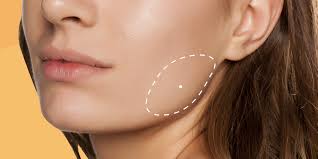 I tried it, and it worked. I Tried Masseter Botox To Treat My Jaw And Teeth Grinding Glamour