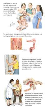 Finally, some can be noticed through changes in the digestive tract, while others can impact on the whole body. Anal Fissure Colon Rectal Surgery Spectrum Health