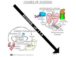 Images Are Credited To Nursing Education Consultants Inc Nursing Mnemonics Nurse Nursing Education