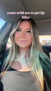 GUYS IM OBSESSED! Visit evolvemedspa.com to book now 😊 #evolvemedspa  #lipfiller #transformation