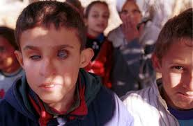 Finally, the council does not have a catalogue of depleted uranium ammunition in current use. Petition Donald Trump End The Use Of Depleted Uranium In The Us Military Change Org