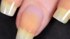 Un Super Soin Reparateur Et Fortifiant Fait Maison Pour Les Ongles Ongles Jaunes Avoir De Beaux Ongles Ongles