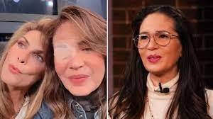 ¿Qué enfermedad padece Yolanda Andrade? El aneurisma en su ojo no fue lo  más grave | Univision Famosos Icons | Univision