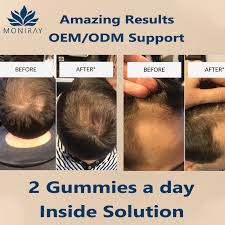 5.2 a month after using biotin supplement treatment. Man Hair Growth Gummy Bears Vitamins Biotin Gummies With Private Label Sugar Bear Supplement Buy Man Hair Growth Gummy Man Hair Vitamins Private Label Sugar Bear Supplement Product On Alibaba Com