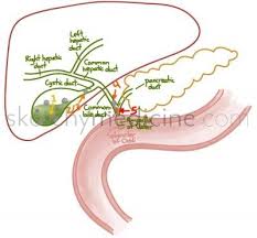 Gallbladder Disease Cholelithiasis Biliary Colic Cholecystitis Choledocholithiasis Cholangitis Medical School Stuff Pharmacology Nursing Nursing Mnemonics