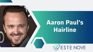 Aaron Paul's Hairline