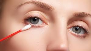 Die entzündung am lid ist meist harmlos, aber lästig. Augen Was Hilft Bei Einer Lidrandentzundung Ndr De Ratgeber Gesundheit