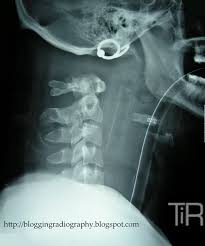 Topics In Radiography Radiology Radiography Radiology Student