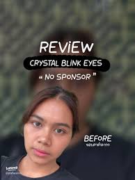 รีวิว Crystal Blink Eye: แก้ปัญหาขอบตาคล้ำอย่างไรให้ใส