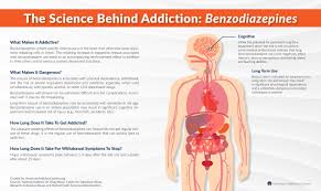 Image result for Benzodiazepine Intoxication