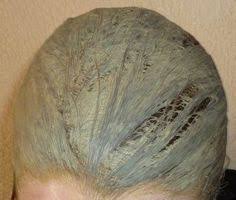 Masque Argile Verte Cheveux Gras Argile Cheveux Cheveux Gras Masque Pour Cheveux Gras