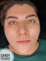 Aumento de labios!!! Excelente Rejuvenecimiento ✨ Elimina Pliegues y  arrugas, aporta volumen Labios más SALUDABLES y HERMOSOS ♥️