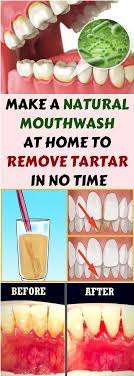 Take a regular wood pencil, remove the metal eraser holder thing on the end. How To Remove Braces Glue At Home Arxiusarquitectura