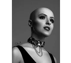 The Ignored Cause: Hair Loss