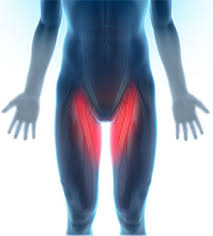 Since a groin injury is an injury like all the others, it is extremely recommended that you go see a when someone suffers a groin injury, they are suffering from the same kind of harm that occurs. Groin Injuries In Athletes Eugene Or Sports Hernia Corvallis Or