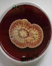 Image result for Allophylus ferrugineus