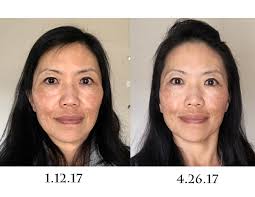 Danielle now offers international teacher training courses and her face. The Ultimate Guide To Face Yoga Method Off 56