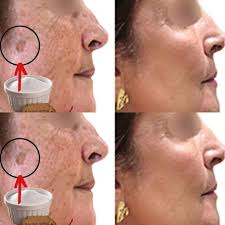 4 Ways to Erase Age Spots with Baking Soda for Younger, More Even  Skin](https://secret-recipes.gogorecipe.com/4-ways-to-erase-age-spots-with-baking-soda-for-younger-more-even-skin/)