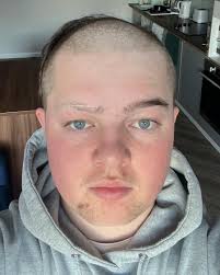 Introducing our bravest fresher of the year @joemi11er who for movember got  an amazing new haircut. Last year was @boo_m.i__n with the R9 haircut but  this year have chosen a more rugby