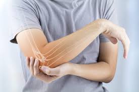 Additionally, median nerve entrapment at the elbow level results in pronator teres syndrome while ulnar nerve entrapment causes cubital tunnel syndrome at the elbow and guyon canal syndrome at the wrist (muramatsu et al., 2008). Elbow Cubital Tunnel Release Ulnar Nerve Transposition Aoa Orthopedic Specialists