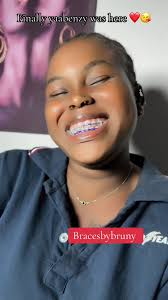 Fashion Braces Ghana: A Trendy Transformation