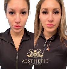Aesthetic beauty lounge is a modern, innovative space where aesthetic injections are prioritized. Premier Aesthetic Center Aesthetic Beauty Lounge Highland Park Il